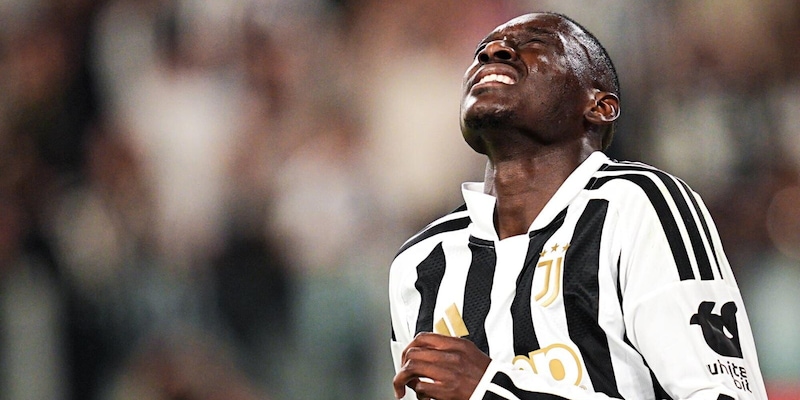 Juve, quanta sfortuna: Kolo Muani si opera per la frattura al dito di una mano
