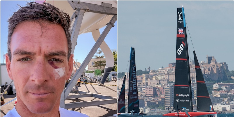 I segni dello scontro sul viso del velista: "In Coppa America non è tutto rose e fiori"